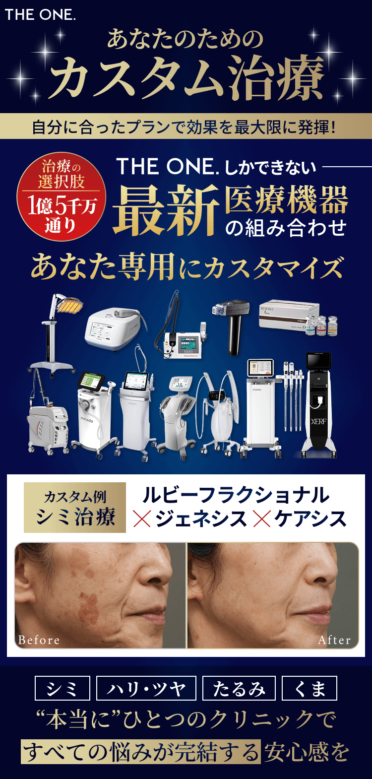 THE ONE.だからできる。最新医療機器であなたのためのカスタム治療