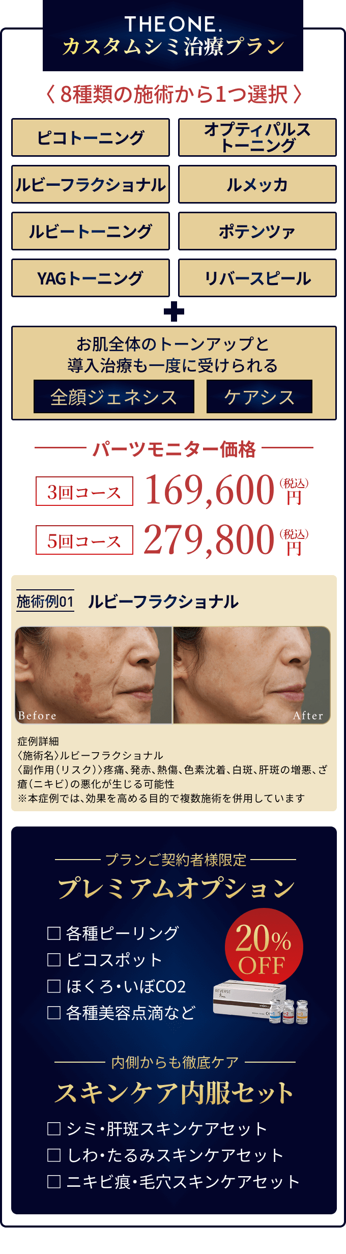 カスタムシミ治療プラン