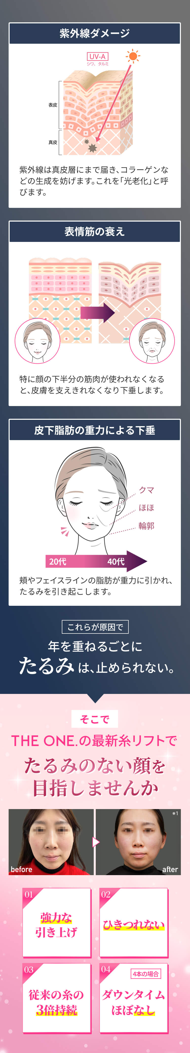 紫外線ダメージ、表情筋の衰え、皮下脂肪の重力による下垂