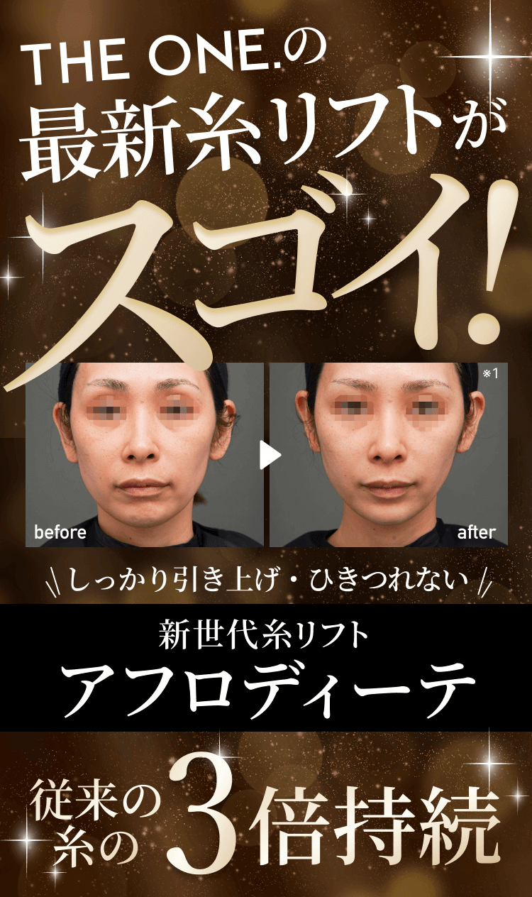 THE ONE.の最新糸リフトがスゴイ！