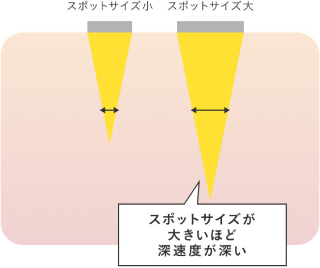 スポットサイズ小 スポットサイズ大 スポットサイズが大きいほど深速度が深い